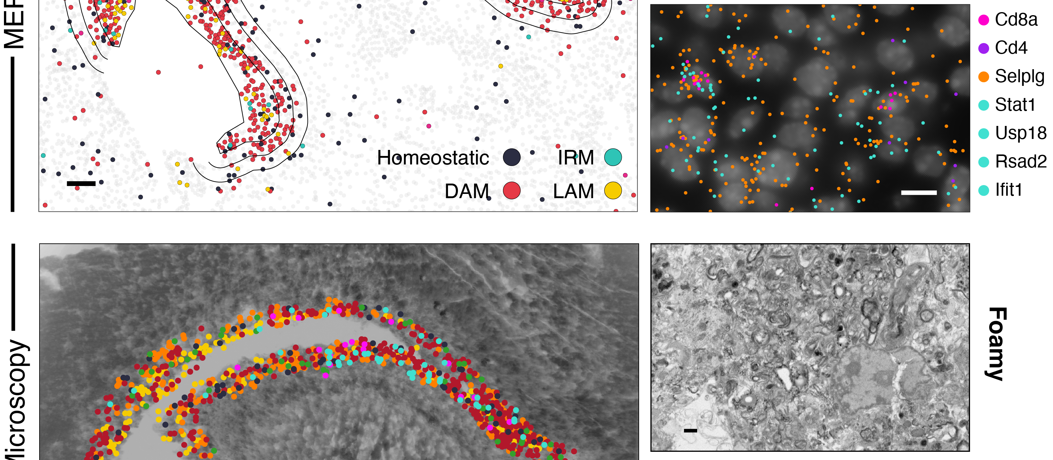 Spatial Transcriptomics-correlated Electron Microscopy