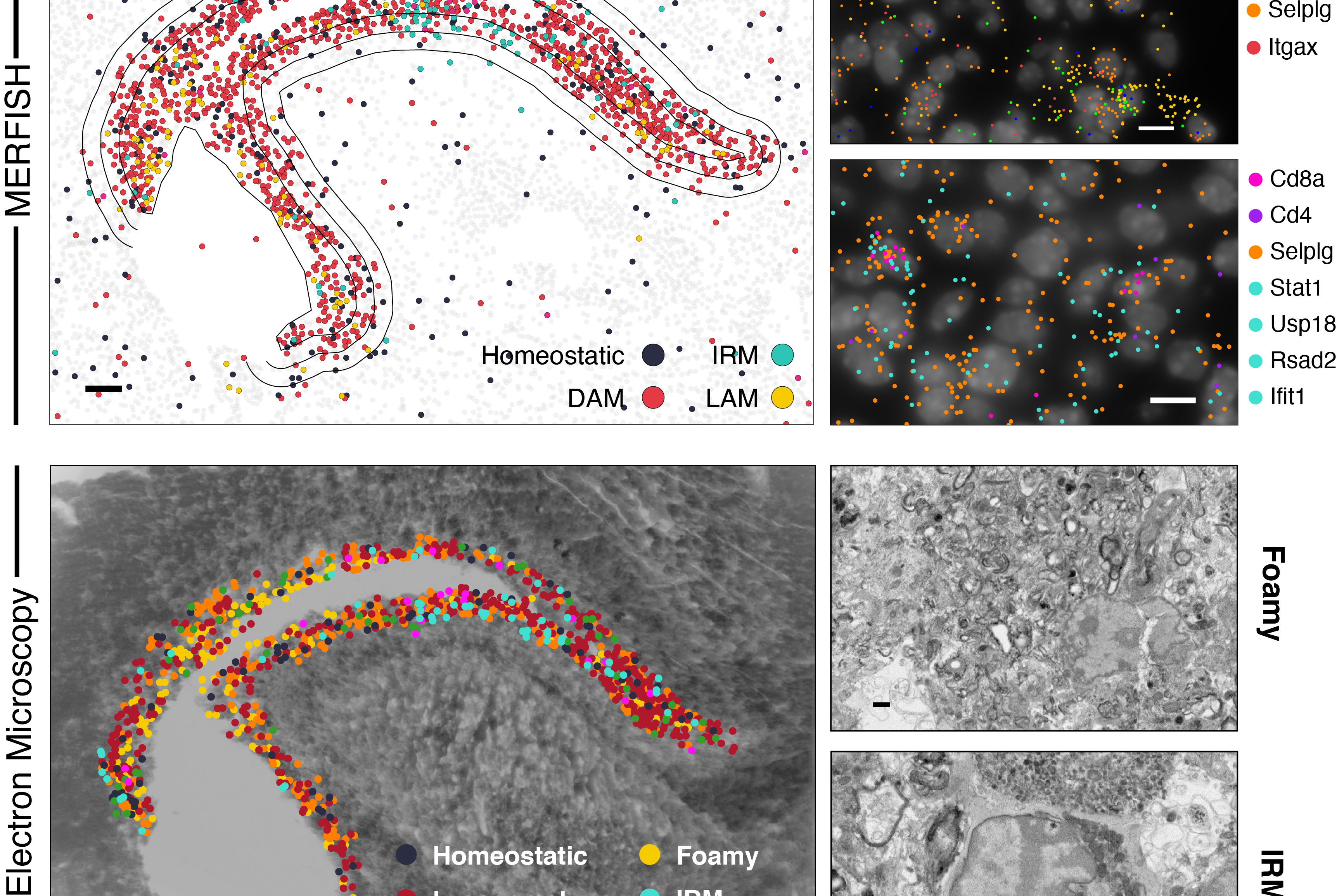 Spatial Transcriptomics-correlated Electron Microscopy